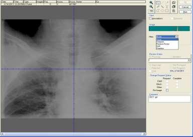 IGRT based targeting in the Thorax Απεικόνιση μέσω