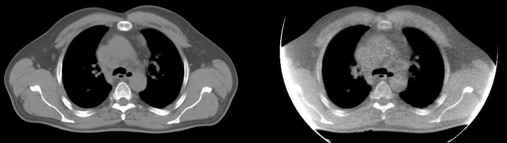 CT and VRCT Image sets using