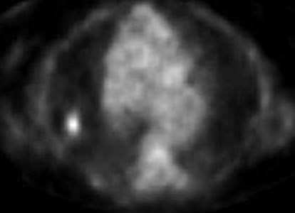53 M, COPD, ct1an0m0 (1.