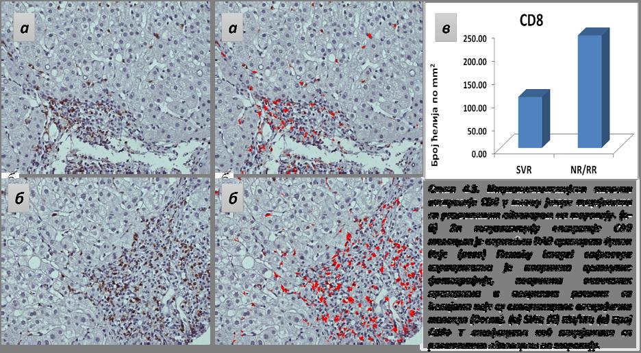 Насупрот CD4+ ћелијама, CD8+ лимфоцити се у нешто већем броју налазе интралобуларно, у синусоидима и у склопу уни и мултицелуларних некроза, а њихов број је већи у конфлуентним мостним и перипортним