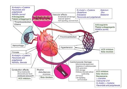 Major mechanisms causing