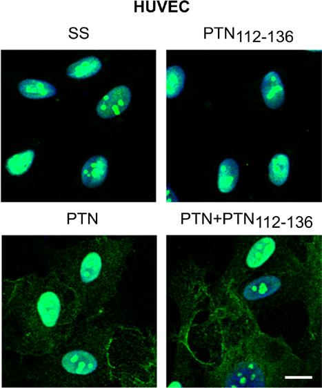 Αποτελέσματα διατριβή, διερευνήθηκε ο πιθανός ρόλος του πεπτιδίου PTN 112-136 στον ενδοκυτταρικό εντοπισμό της NCL παρουσία είτε απουσία PTN.
