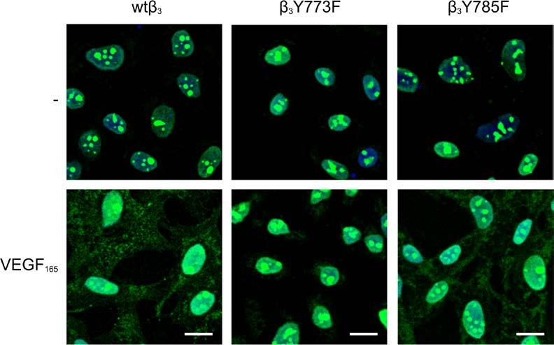 Αποτελέσματα Εικόνα Α25: Μελέτη επίδρασης του VEGF 165 στον ενδοκυτταρικό εντοπισμό της NCL σε σχέση με την παρουσία των τυροσινών 773 και 785 της υπομονάδας β 3.