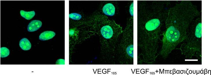 Αποτελέσματα Ο ενδοκυτταρικός εντοπισμός της NCL φαίνεται να είναι ανεξάρτητος από την ενεργοποίηση του υποδοχέα VEGFR-2 υπό την επίδραση VEGF 165, καθώς η μπεβασιζουμάβη (αναστολέας πρόσδεσης του