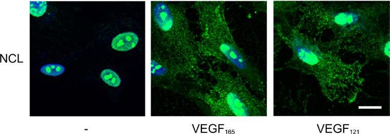 Αποτελέσματα Εικόνα Α28: Μελέτη του ενδοκυτταρικού εντοπισμού της NCL υπό την επίδραση VEGF 121. Αντιπροσωπευτικές εικόνες απλού ανοσοφθορισμού με αντίσωμα έναντι της NCL (πράσινο) σε κύτταρα HUVEC.