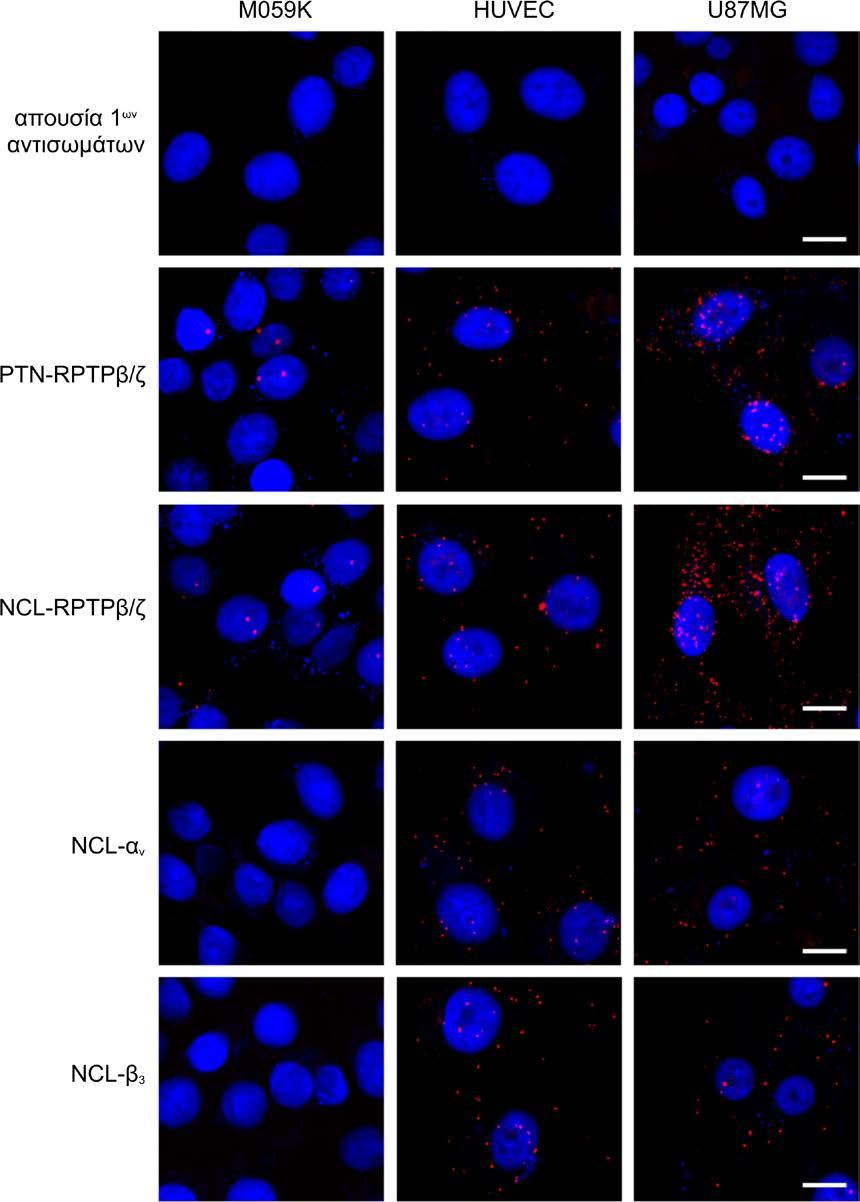 Αποτελέσματα υποδοχέα RPTPβ/ζ στα κύτταρα M059K.