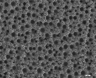 5 Co-MoZn SEM micrographs of Co-Mo-Zn electrodeposit at 500mA/cm2