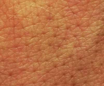 Κεφάλαιο 3 Δομή του δέρματος Η επιφάνεια του δέρματος είναι μεγαλύτερη από την επιφάνεια του σώματος αφού σε μερικές περιοχές αναδιπλώνεται και σχηματίζει τους βλεννογόνους.