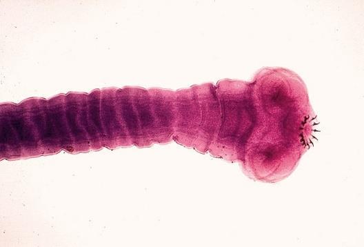 3. ΦΥΛΟ: ΠΛΑΤΥΕΛΜΙΝΘΕΣ (Platyhelminthes) - Ομοταξία/Κλάση: Κεστώδεις/ταινίες Taenia solium (ταινία των χοίρων) - Νεαρές μορφές στους μυς των χοίρων και ενήλικο στάδιο στο λεπτό έντερο του ανθρώπου.