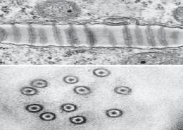 Διακυτταρική μετακίνηση (τοπική) Για μετακίνηση από 1 κύτταρο στο άλλο, οι ιοί
