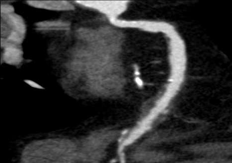 (pink arrows) resulting in a relatively
