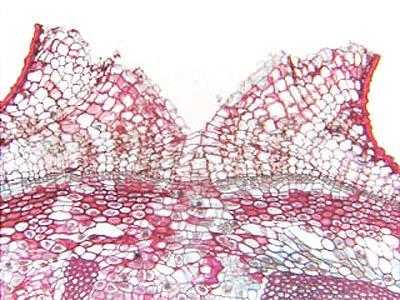 Φακίδιο αποτελείται από κύτταρα φελλού διαταγμένα σε σειρές μεταξύ των οποίων