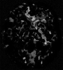 پردازش تصویر در :MATLAB خواندن تصویر در محیط MATLAB با استفاده از تابع imread و نمایش آن توسط تابع imshow انجام می پذیرد. به عنوان مثال دستور زیر تصویر rice.