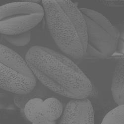 02-1 تعدیل هیستوگرام یکی دیگر از کاربردهای هیستورگرام در افزایش کنتراست تصاویر با کنتراست پایین است.