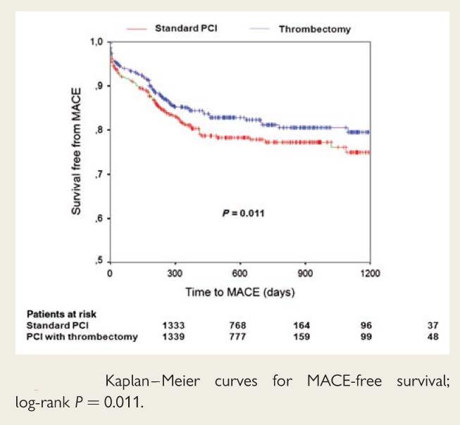 Thrombectomy in STEMI