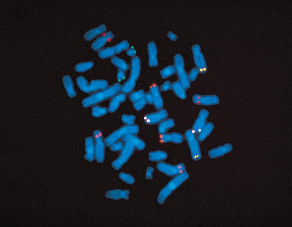 Φθξοίζχμ σβοιδιρμόπ in situ (Fluorescence in situ hybridization, FISH) Αμιυμεσςέπ DNA