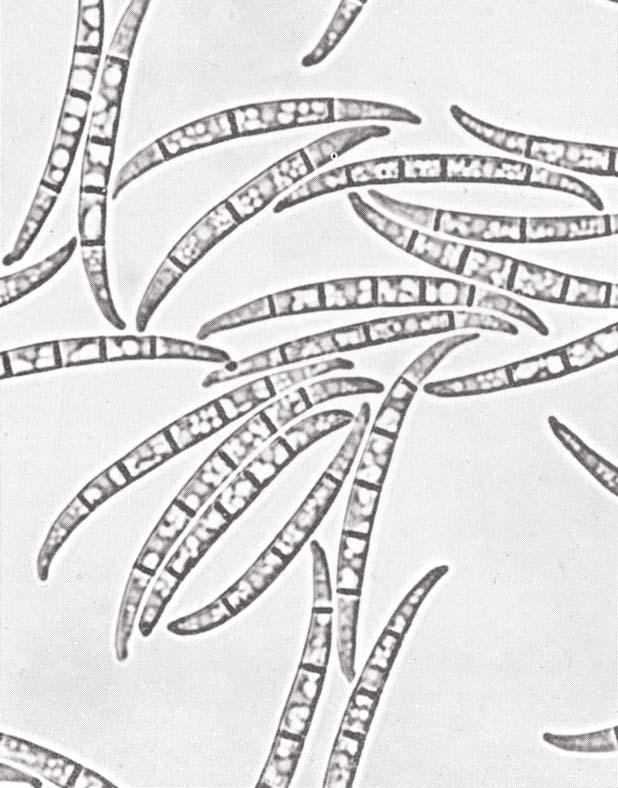 Εικόνα 3. μύκητας Fusarium oxysporum.