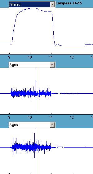 ΗΜΚ Μέγιστη Τιμή Nm ½ χρόνου χαλάρωση Χρόνος σύσπασης Χρόνος (msec) Σχήμα 12: Σχηματική παράσταση της προκλητής ροπής και των μηχανικών και ελαστικών