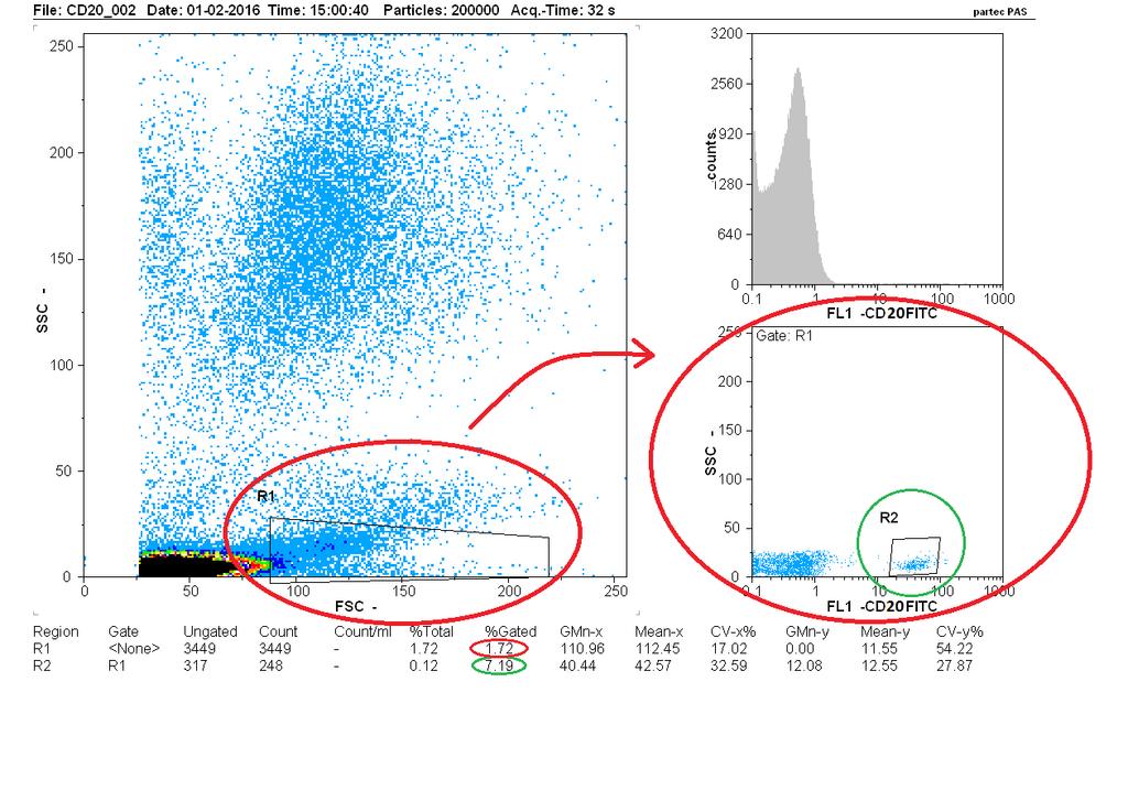 Εικόνα 3. Στικτόγραμμα στιβάδας PBMC. Στην περιοχή R1 παρατηρούμε τον πληθυσμό των λεμφοκυττάρων.