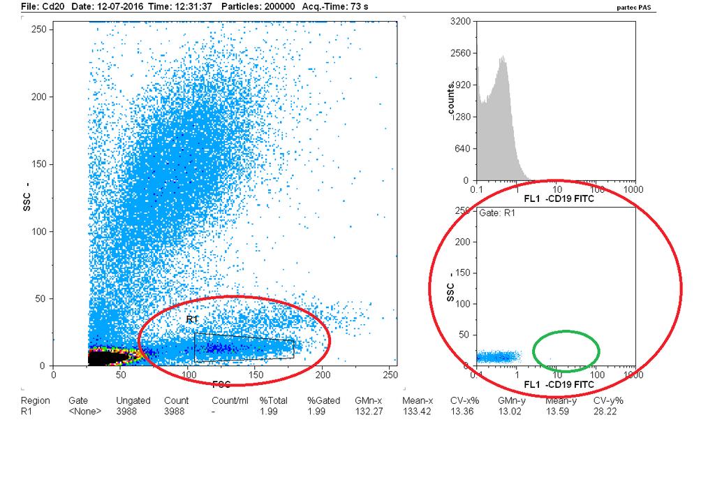 Εικόνα 4. Επιλέχθηκε ο πληθυσμός των λεμφοκυττάρων (περιοχή R1), αλλά στο στικτόγραμμα της R1 δεν παρατηρείται πληθυσμός συνδεδεμένων με το αντίσωμα.