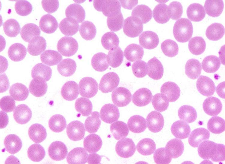 51 Εικ.12.Επίχρισμα αίματος σε πλακίδιο οπτικού μικροσκοπίου με ερυθρά αιμοσφαίρια και φυσιολογικά αιμοπετάλια (Χ 1000).