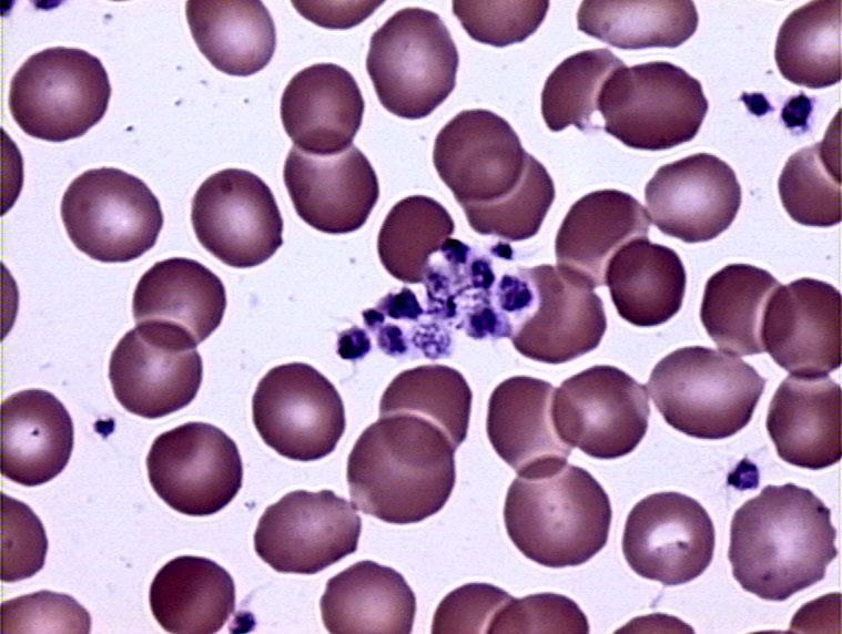 53 Εικ.13. Φωτογραφία από οπτικό μικροσκόπιο σε μεγάλη μεγέθυνση αθροίσματος αιμοπεταλίων στο περιφερικό αίμα που έχουν υποστεί χρώση Wright.