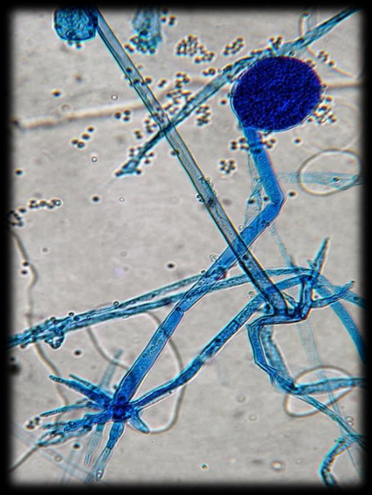 Rhizopus spp.