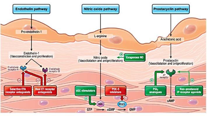 Ambrisentan po Macitentan po Sildenafil po Tadalafil po Vardenafil po Epoprostenol IV