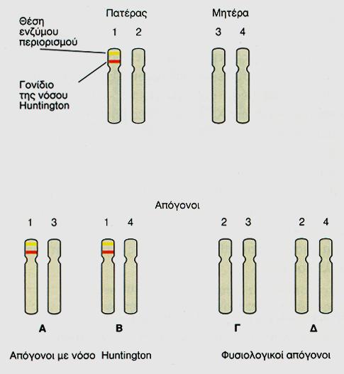Νόσος του Huntington Συχνότητα 1:20.000 άτοµα (ίδια σε άνδρες και γυναίκες) -εµφανίζεται στην ηλικία των 25-60 -οδηγεί σε επιλεκτική απώλεια νευρώνων G.