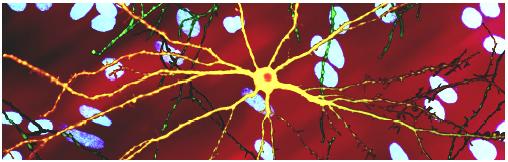 Huntigtin: δράση της φυσιολογικής πρωτεϊνης και µοριακή βάση της ασθένειας Η ακολουθία πολυγλουταµίνης της πρωτεΐνης των ασθενών είναι τοξική για τους νευρώνες: συσσωµατώµατα σε νευρώνες (in vitro)