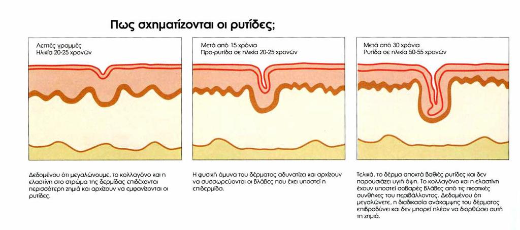 Επίσης, οι ρυτίδες διακρίνονται σε: γραμμοειδείς, εκφραστικές, ανάγλυφες, δυναμικές, κινητικές και μικτές.