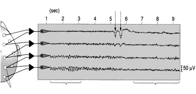Το ύψος του ρυθμού α ποικίλει από 5-100μV (συνήθως 50 μv). Καταγράφεται κατά την εγρήγορση, όταν ο εξεταζόμενος έχει τα μάτια κλειστά.