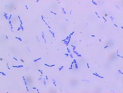 1.6 Listeria spp. Γεληθά ραξαθηεξηζηηθά Δίκαζ Gram+, εεηζημί ζηδκ ηαηαθάζδ, ανκδηζημί ζηδκ μλεζδάζδ, αενυαζμζ-πνμαζνεηζηά ακαενυαζμζ, ιδ ζπμνμβυκμζ, ροπνυηνμθμζ αάηζθθμζ, δζαιέηνμο 0,4-0,5ιm ηαζ 0.