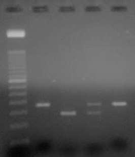 Κεφάλαιο 3 ο ΑΠΟΤΕΛΕΣΜΑΤΑ 3.1 Μελέτη των πολυμορφισμών του ογκοκατασταλτικού γονιδίου p16 Εικόνα 3.1.Γενότυποι του πολυμορφισμού C580Τ όπως προέκυψαν από την ανάλυση PCR-RFLP και την ηλεκτροφόρηση σε πήκτωμα αγαρόζης συγκέντρωσης 3%, όπως περιγράφηκε παραπάνω.