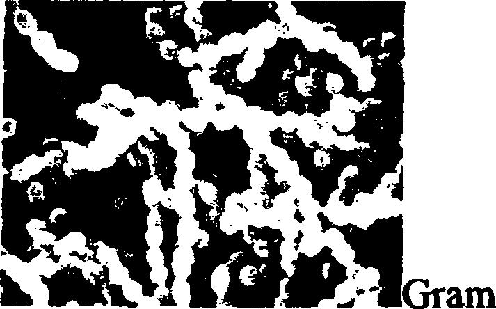 S. salivarius subsp. therm ophilus: (κοινό όνομα Streptococcus thermophilus) θετικό, facultative αναερόβιο βακτήριο. Συναντάται σε ζεύγη ή σχηματισμένες αλυσίδες.