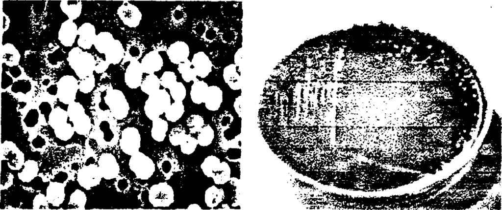 1.2..4. Γένος Pediococcus sp. Οι πεδιόκοκκοι ανήκουν στα gram θετικά βακτήρια και ταξινομούνται στην οικογένεια Lactobacillaceae. Αναπτύσσονται σε ζευγάρια ή τετράδες (wikipedia).