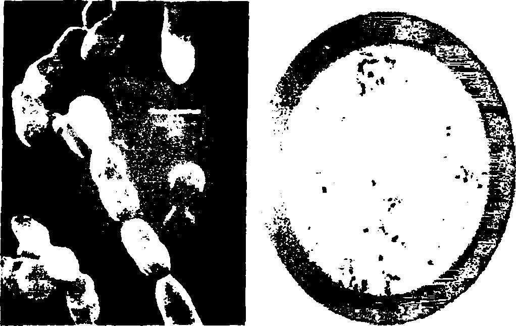 1.2.13, Γένος Propionibacterium sp. Τα βακτήρια αυτά πήραν το όνομά τους από την ικανότητά τους να παράγουν προπιονικό οξύ.