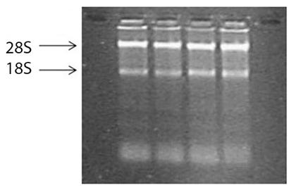 Εικόνα 3.1. Ηλεκτροφόρηση απομονωμένου ολικού RNA από ιστολογικά δείγματα παχέος εντέρου. Διακρίνονται οι ζώνες των μορίων 18S και 28