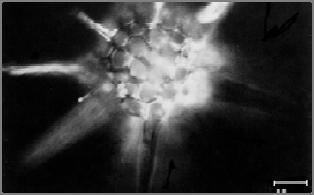 Optical Microscopy vs Scanning Electron Microscopy radiolarian OM m