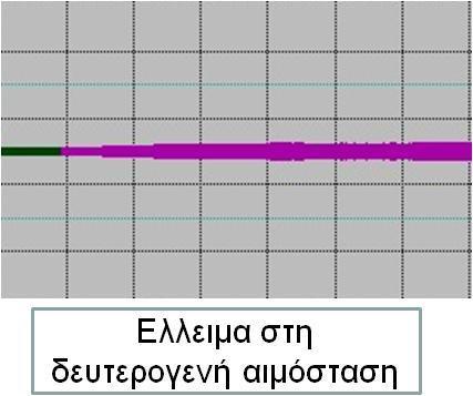 Τα αποτελέσματα της TEG αξιολογούνται κατάλληλα για την καλύτερη αντιμετώπιση των ασθενών με