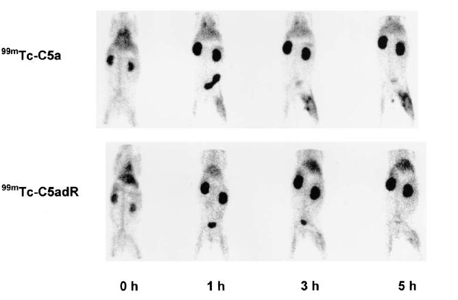 In vivo απεικόνιση βακτηριακής λοίµωξης µε τη χρήση ραδιοσηµασµένου ( 99m