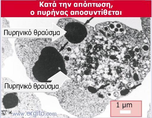 Στο επάνω πλαίσιο φαίνεται ένα φυσιολογικό κύτταρο.