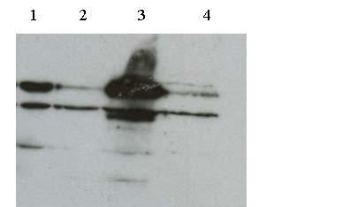 CastortGFP τουμπουλίνη Εικόνα 27: Ανάλυση κατά Western κυτταρικών εκχυλισμάτων που προέρχονται από HeLa σταθερά διαμολυσμένη κυτταρική σειρά μετά από RNAi για το γονίδιο του Castor.