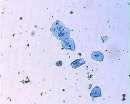 3. Οι πιο κάτω εικόνες δείχνουν κύτταρα όπως φαίνονται στο μικροσκόπιο. α) Ποια εικόνα δείχνει φυτικά κύτταρα; [μον.0.