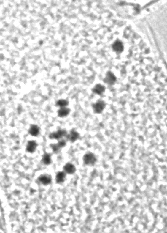 6. Sulla coronaria (L.) Medik. (=Hedysarum coronarium L.) 2n = 2x =16 (Εικ. 34). ΙοΙ: Κεφαλονιά: Λιμένια Πόρου, υψόμ. 0-30 m, 07 Ιουνίου 2008, Καμάρη, Σαμαροπούλου & Σπανού, cult. no SK58 (UPA).