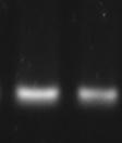 γονιδίου του TLR4 με μ