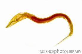 3 Enterobius vermicularis (Οξύουρος) ΜΟΡΦΟΛΟΓΙΚΑ ΧΑΡΑΚΤΗΡΙΣΤΙΚΑ ΕΝΗΛΙΚΟΥ ΠΑΡΑΣΙΤΟΥ. Νηματώδης έλμινθας υπόλευκου- γαλακτώδους χρώματος.