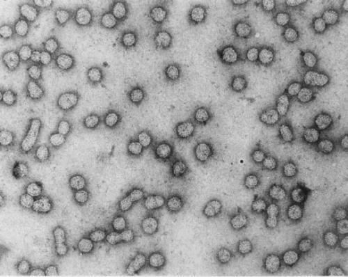 Χαρακτηριστικά του PNRSV Γένος Ilarvirus, Οικογένεια Bromoviridae.