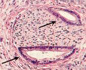 nerve There is a whole family of SMAD proteins, cytoplasmic signaling proteins, all involved in signal transduction