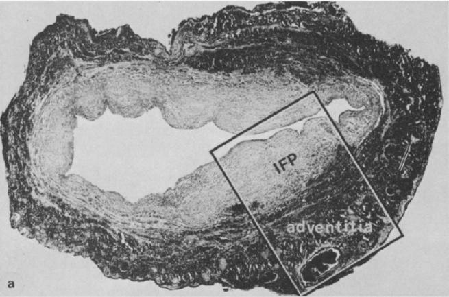 disease different from NCA disease?